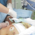 coma indusa