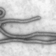 ebola